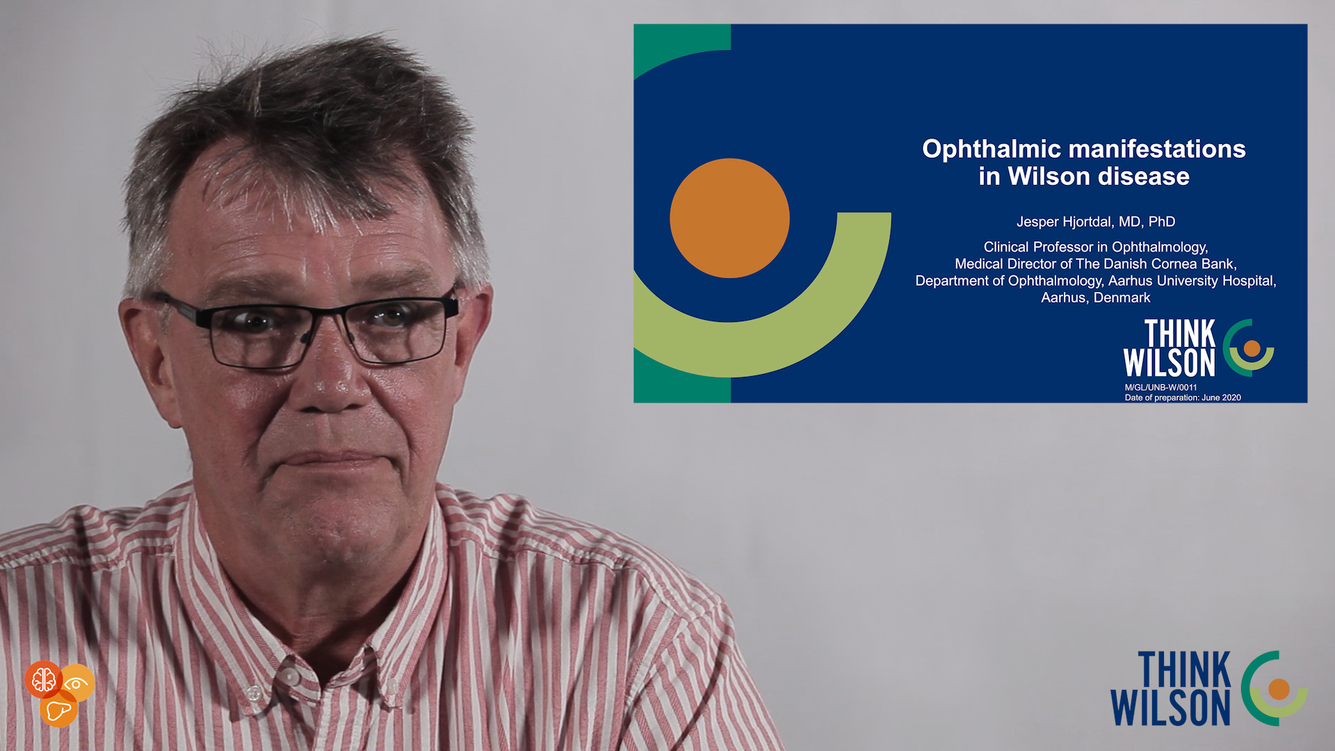 Jesper Hjortdal, MD, PhD. Clinical Professor in Ophthalmology. Medical Director of the Danish Cornea Bank, Department of Ophthalmology, Aarhus University Hospital, Aarhus, Denmark. Explains the ophthalmic manifestations of Wilson's disease.